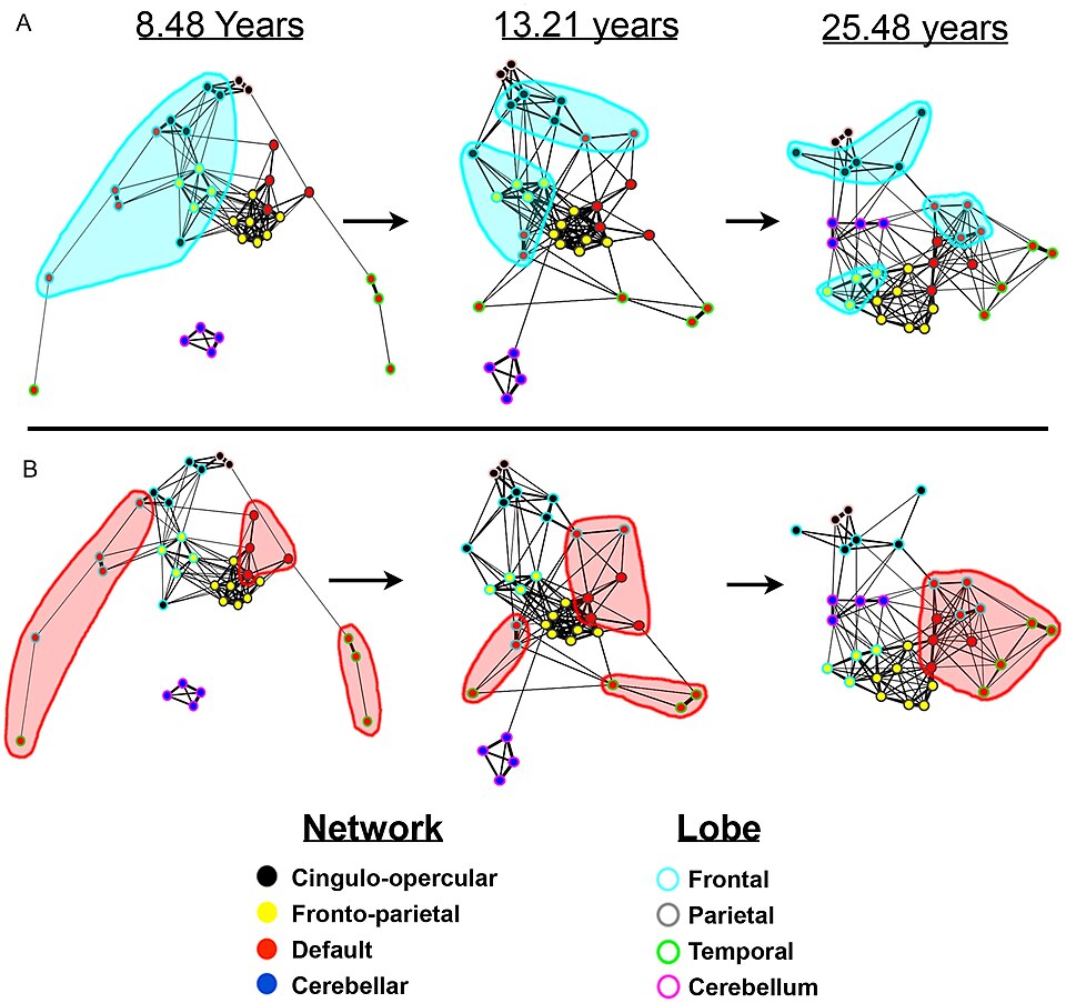Brain network diagram showing neural connections involved in time perception